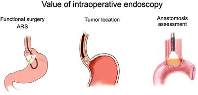 Endoscopy in surgery